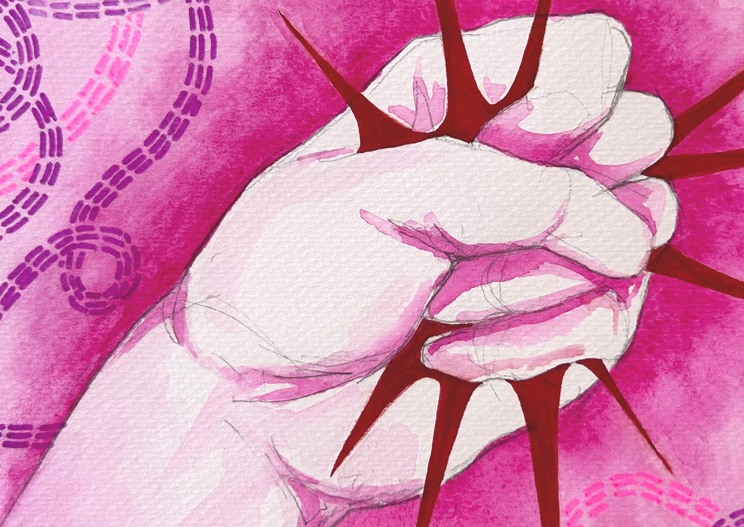 Painful fist